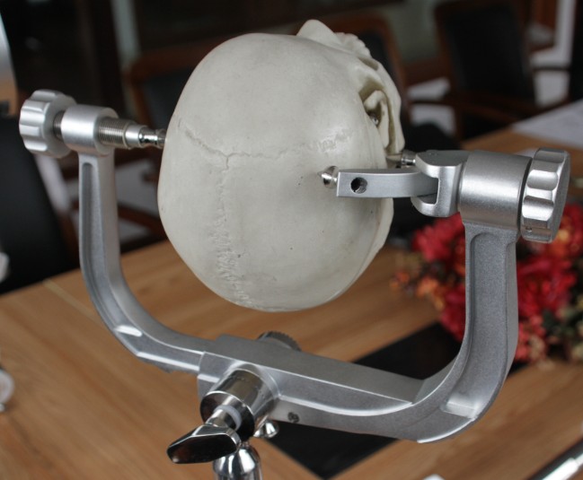Cheap Price Aluminum Alloy Neurosurgery Crainal Stabilization System 3 Three Point Skull Clamp Head Frame