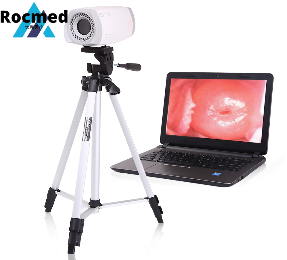 Sony CCD Gynecology Laptop Portable Digital Colposcope Electronic Vaginal Diagnostic Digital Video Colposcopy