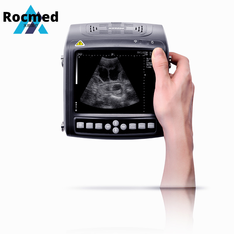 B,2b,4b ,B/M,M Modes 5.7′′ Screen Display Portable Animal Vet Veterinary Handheld Ultrasound Scanner Machine Manufacturer for Pregnancy Test Dog Cat