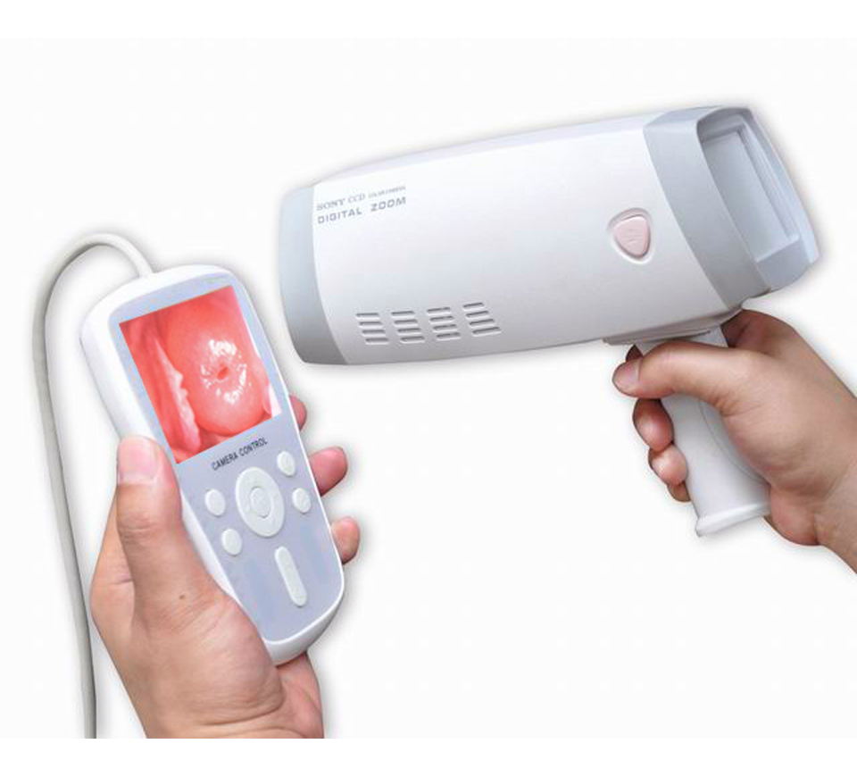 Colposcopy HD Video Colposcope Colposcopy Vagina Video Colposcopy with Sony Camera, Handy Handheld Digital Video Colposcopy
