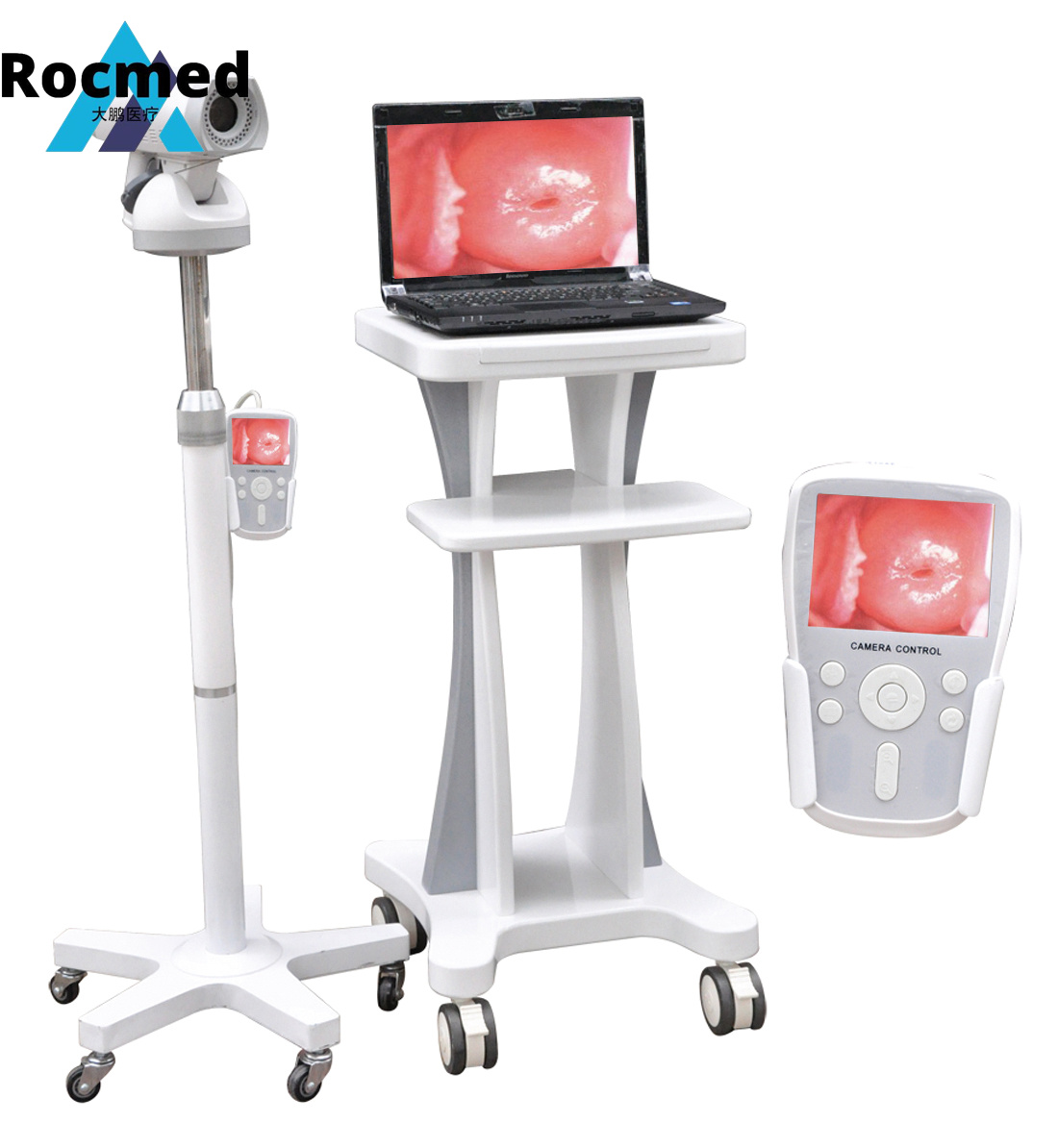 Sony Color Digital CCD Medical Equipment Electronic Colposcope Machine Handheld Electronic Digital Video Colposcopy for Gynecology, Gynecological