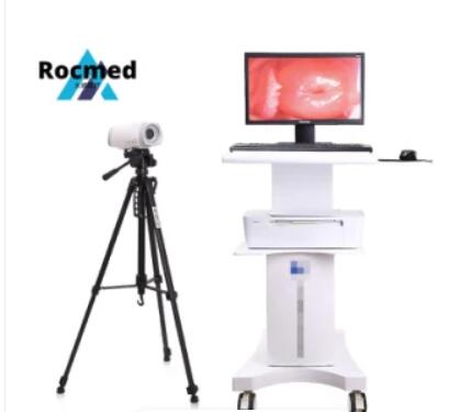 Portable Digital Laptop Hospital Full Digital Electronic Video Surgical Gynecological Colposcope Colposcopy Machine for Woman