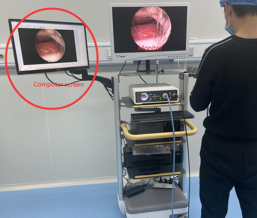 Cheap Price Laparoscopy Camera Full HD 1080P Endoscope Endoscopic Video Camera