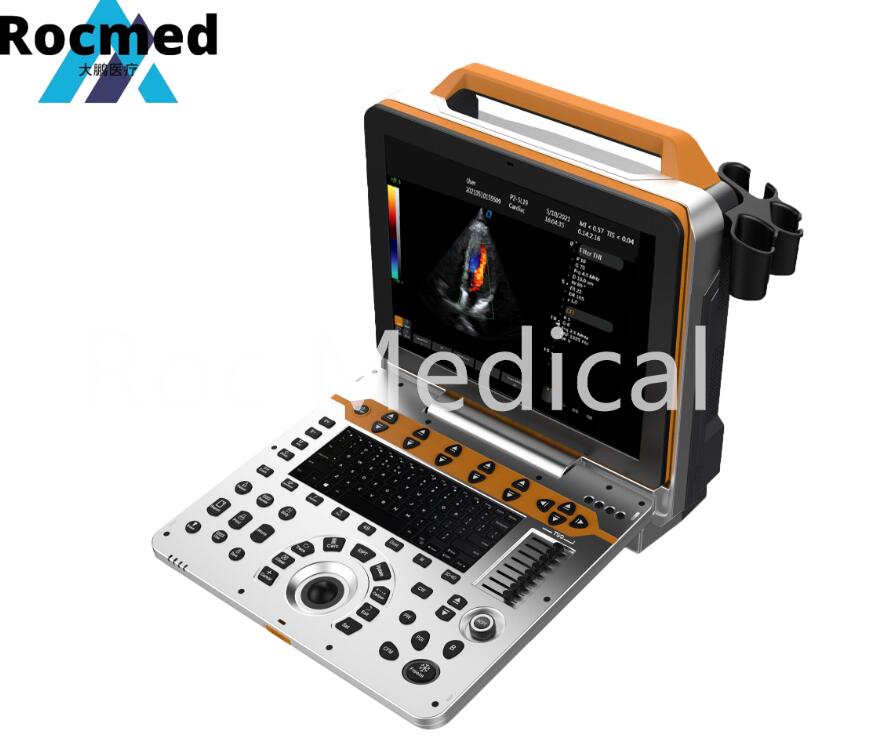 Sonoscape S9 Similar Portable Color Doppler Echo Echocardiography Ultrasound Machine/Ultrasound Scanner